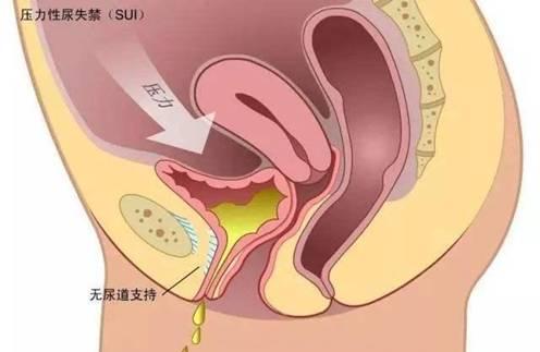 湘雅四院最新动态速递：揭秘医院前沿资讯